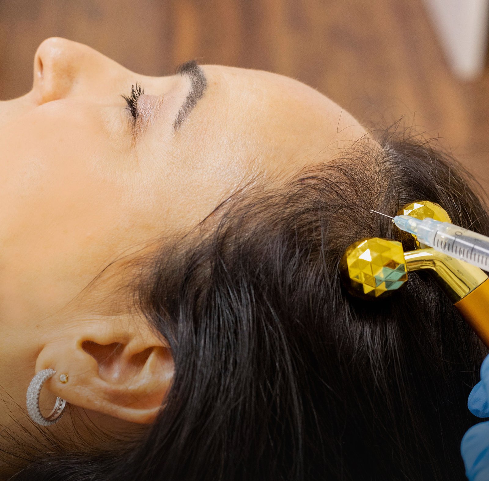 Mesoterapia Facial a