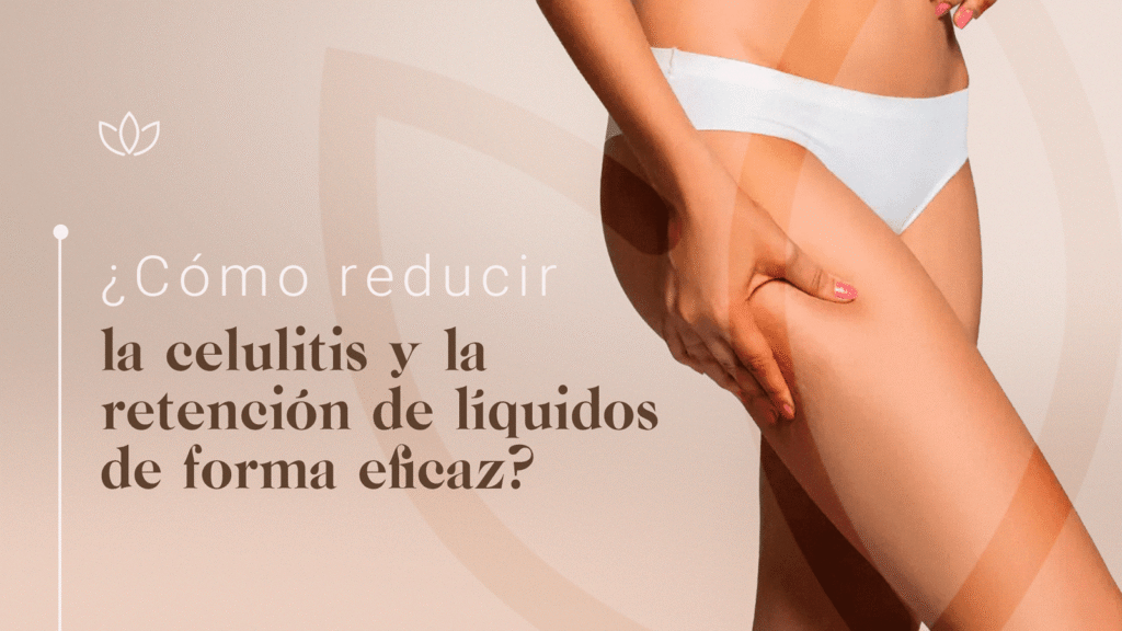 Cómo reducir la celulitis y la retención de líquidos en Madrid