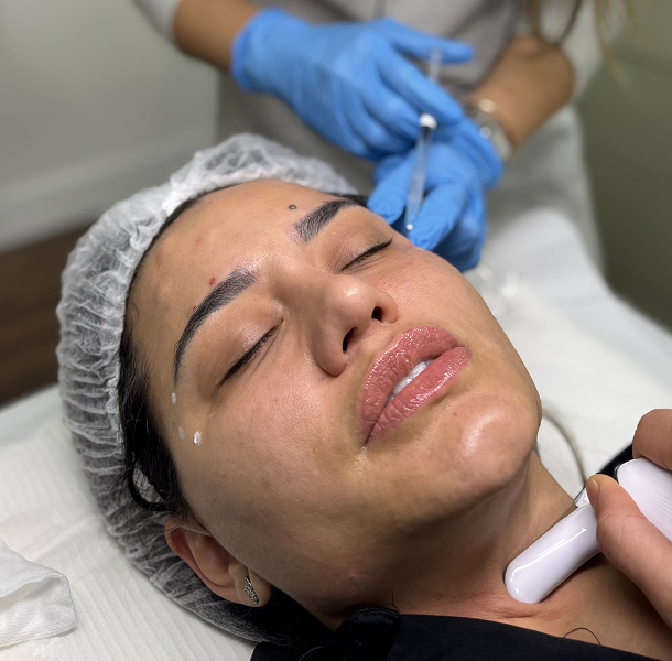 Botox en Madrid 
